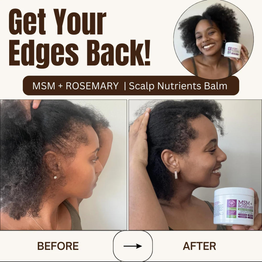 Qhemet Biologics MSM + Rosemary Scalp Nutrients Balm | Scalp Food for Healthy Hair | Vegan (4 oz)