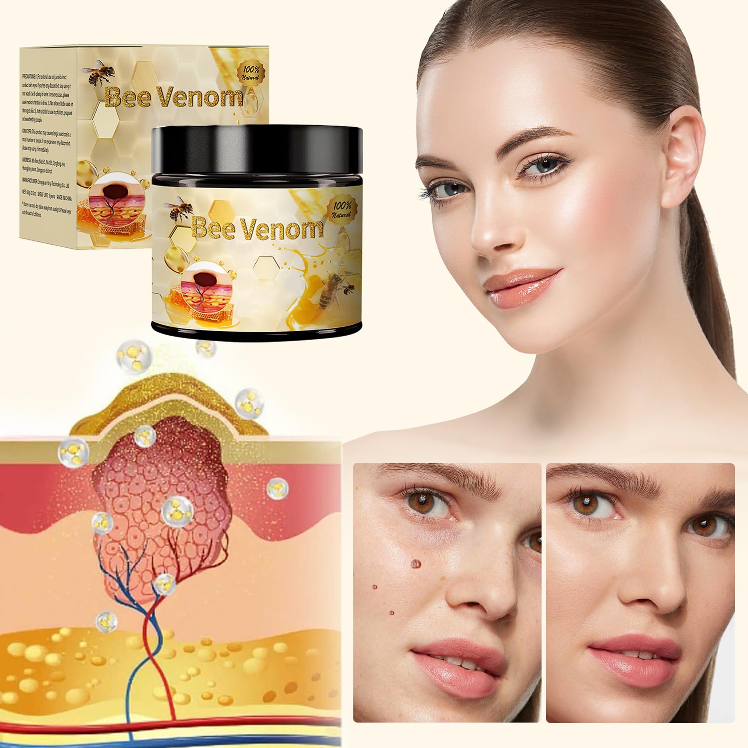 QiFind Bee Venom Skin Treatment Cream – 2025 Professional Repair Cream for All Body Parts (2 pcs)