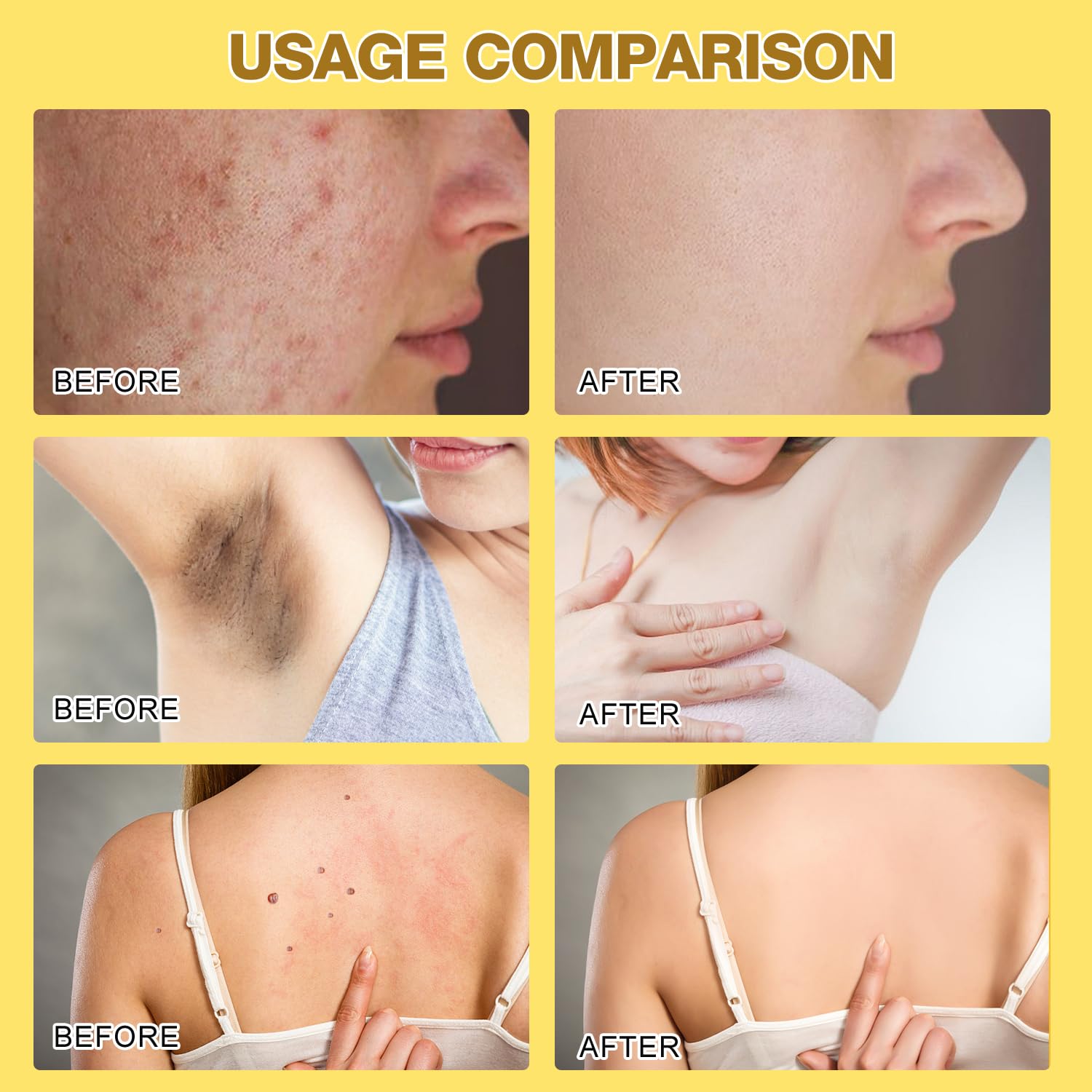 QiFind Bee Venom Skin Treatment Cream – 2025 Professional Repair Cream for All Body Parts (2 pcs)
