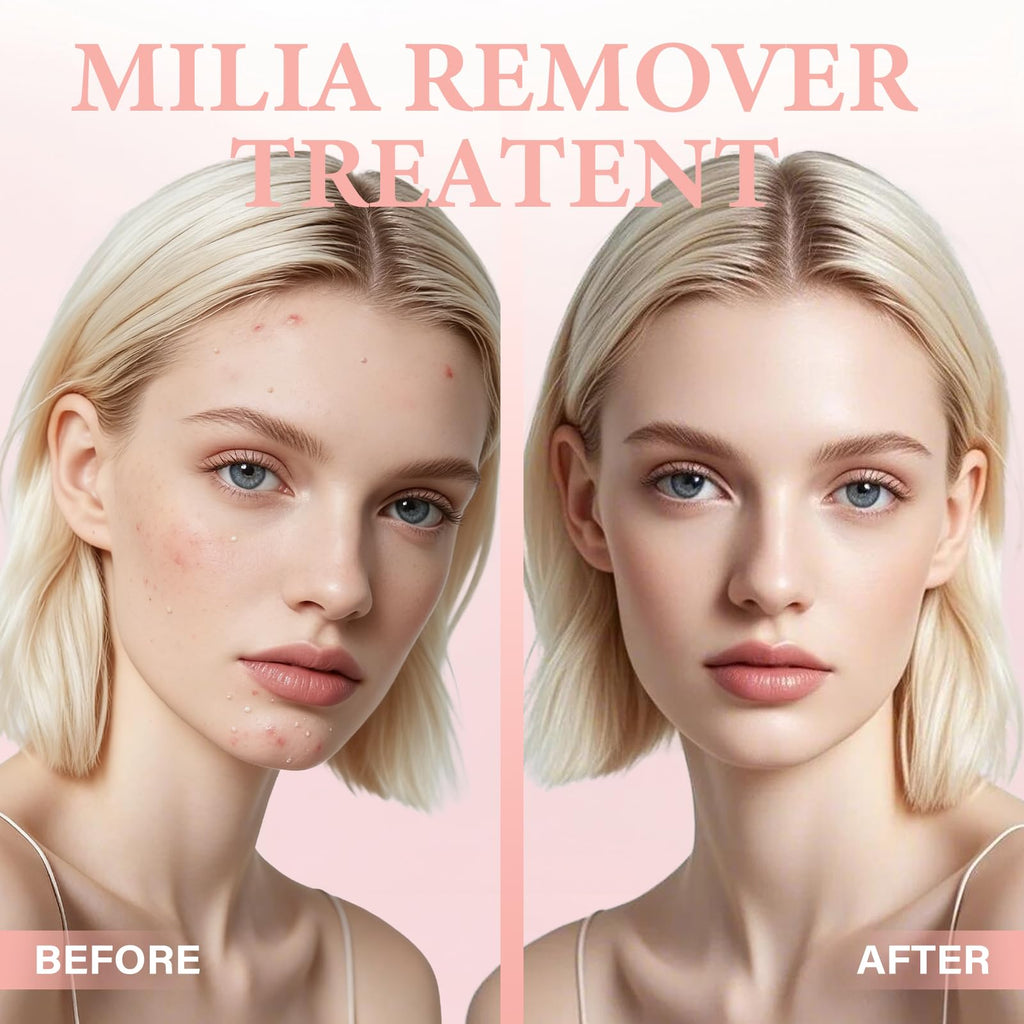 QKDBLWX Milia Remover Serum for Eye & Face — Lightweight, Non-Greasy, Suitable for All Skin Types