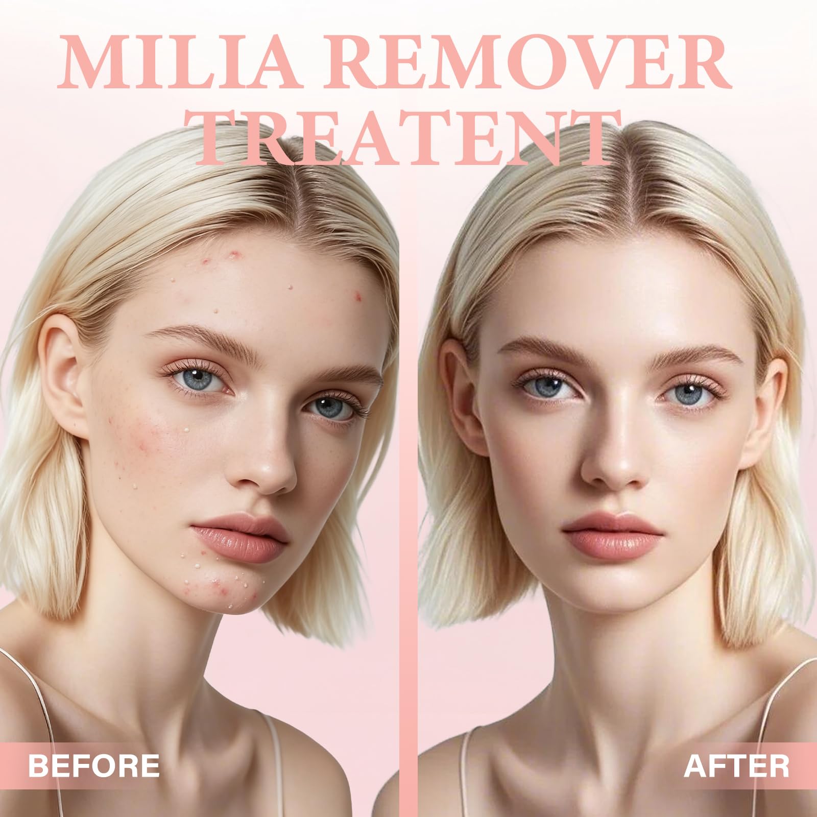 QKDBLWX Milia Remover Serum for Eye & Face — Lightweight, Non-Greasy, Suitable for All Skin Types