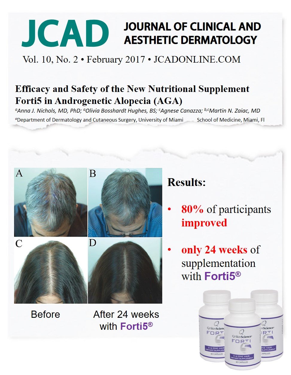 Quintessence Forti5 Hair Growth Nutritional Supplement – 60 Capsules (1 Month Supply)