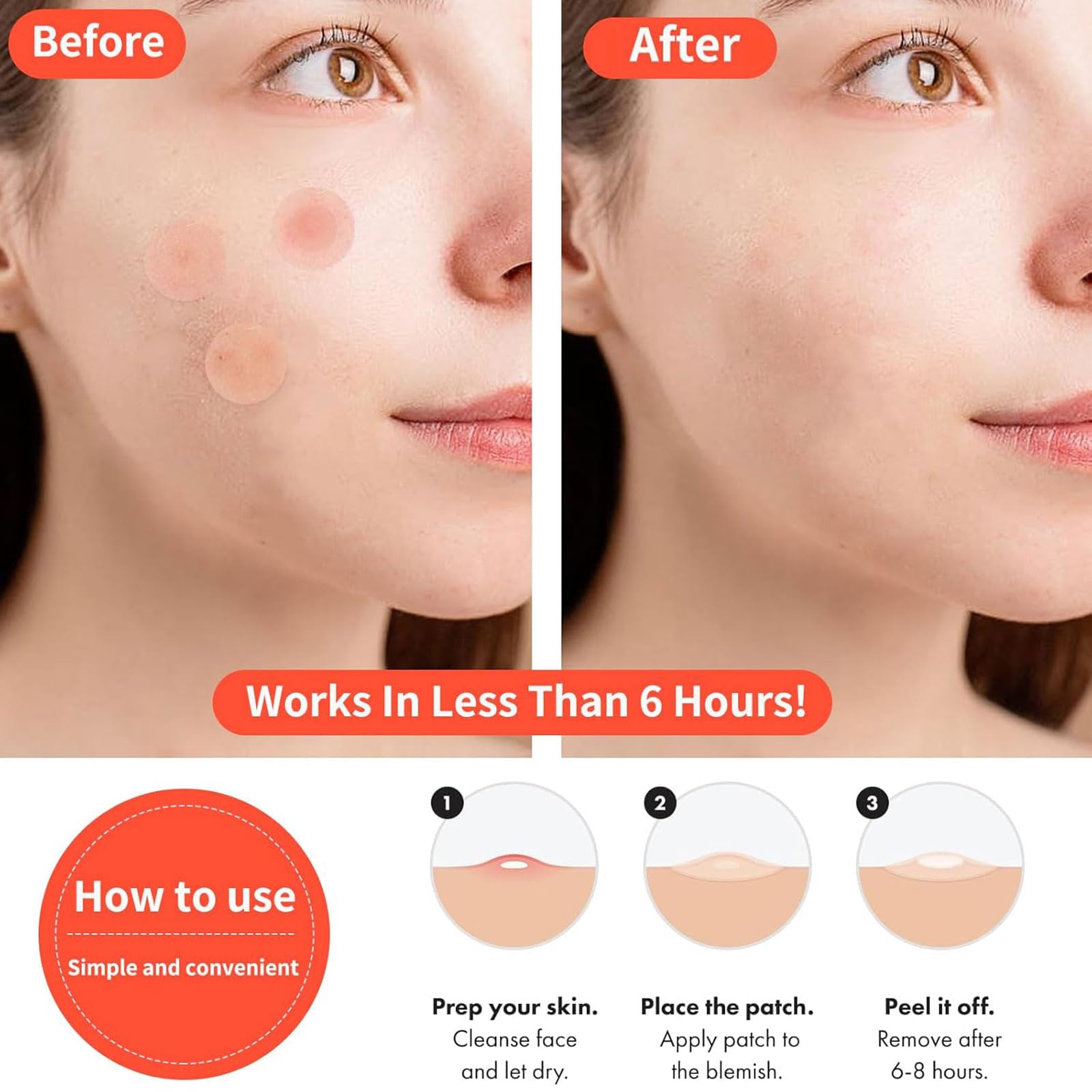 QUYVANDOR Pimple Patches Day & Night — 120 Count, Ultra-Thin Day Patch + Cushioned Night Patch