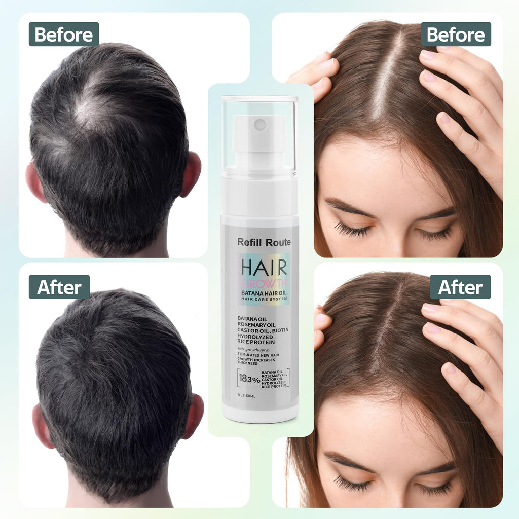 Refill Route Batana Oil Hair Growth Spray – Natural Vegan Hair Regrowth with Rice Water, Biotin & Rosemary