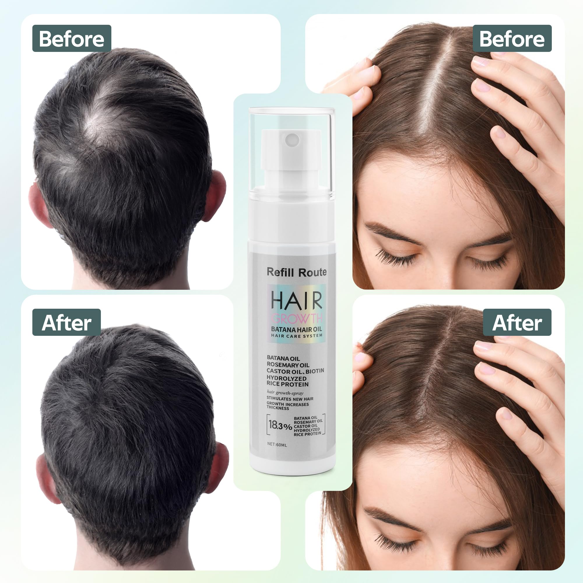 Refill Route Batana Oil Hair Growth Spray – Natural Vegan Hair Regrowth with Rice Water, Biotin & Rosemary