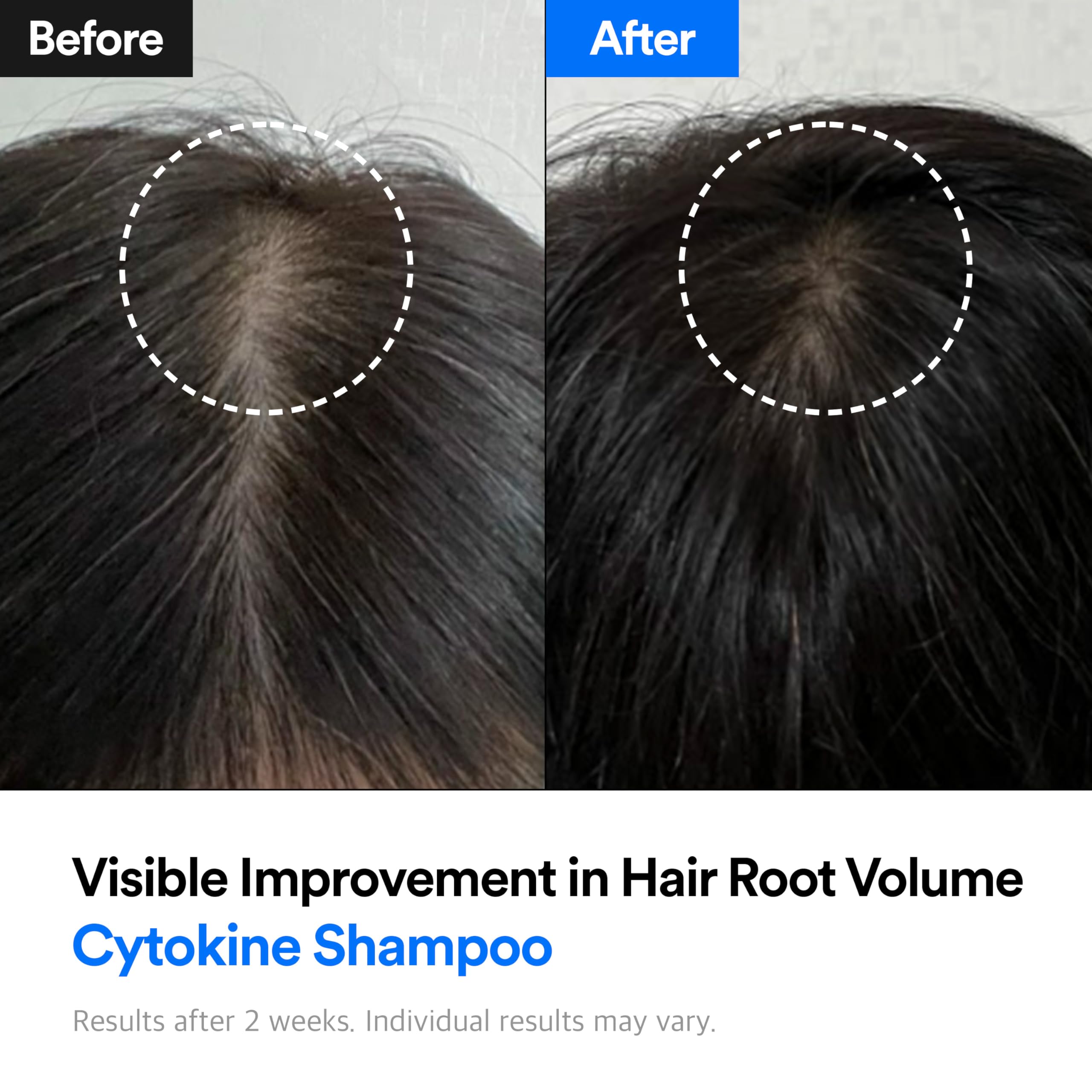 Refilled Hair-Recovery Cytokine Shampoo Plus Sensitive Care – Gentle, Hypoallergenic, Sulfate-Free (12.8 oz)