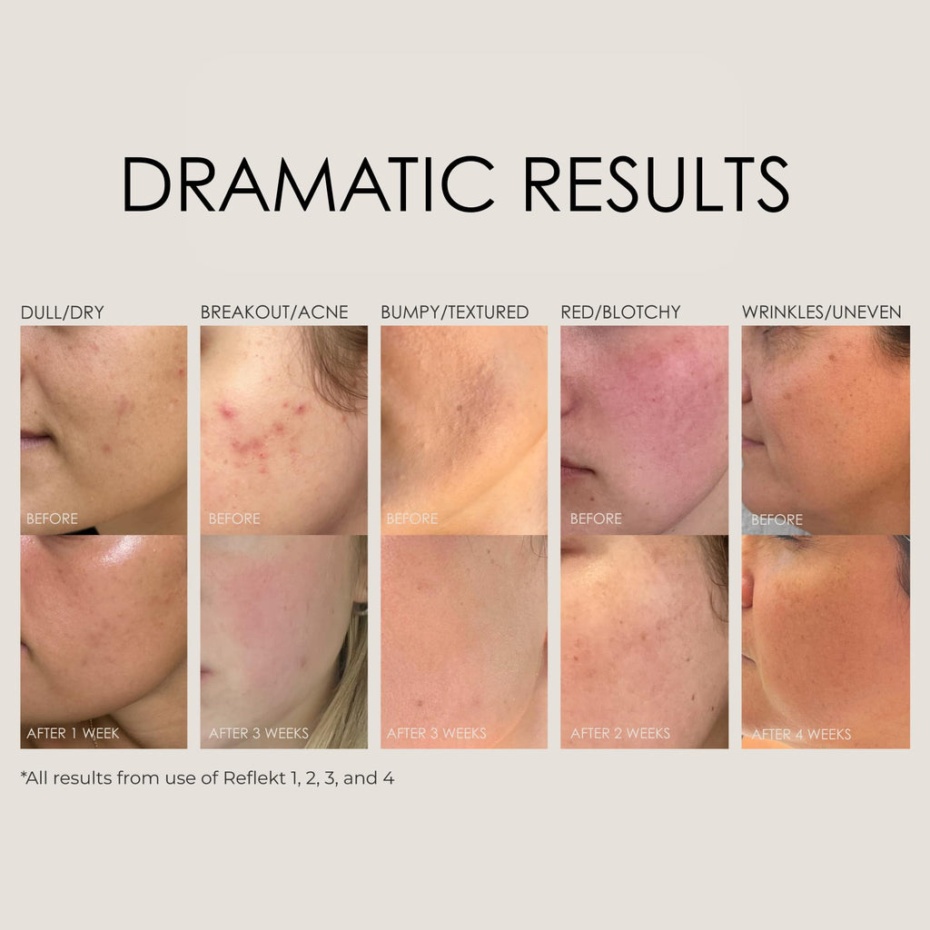 REFLEKT 1 Daily Exfoliating Face Wash – Hydration, Gentle Exfoliation, Vegan & Cruelty-Free