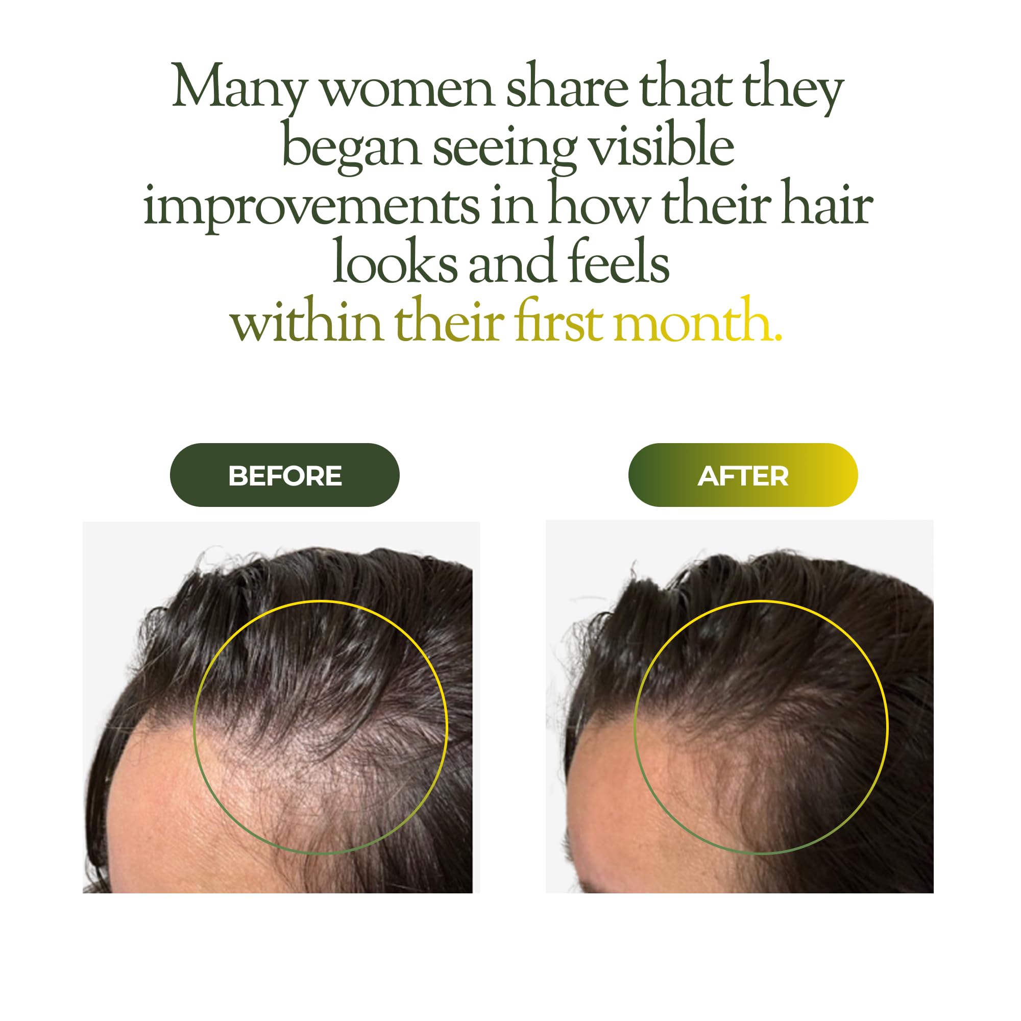 regener8 Hair & Scalp Oil for Women – Natural Support for Hormone-Related Hair Loss