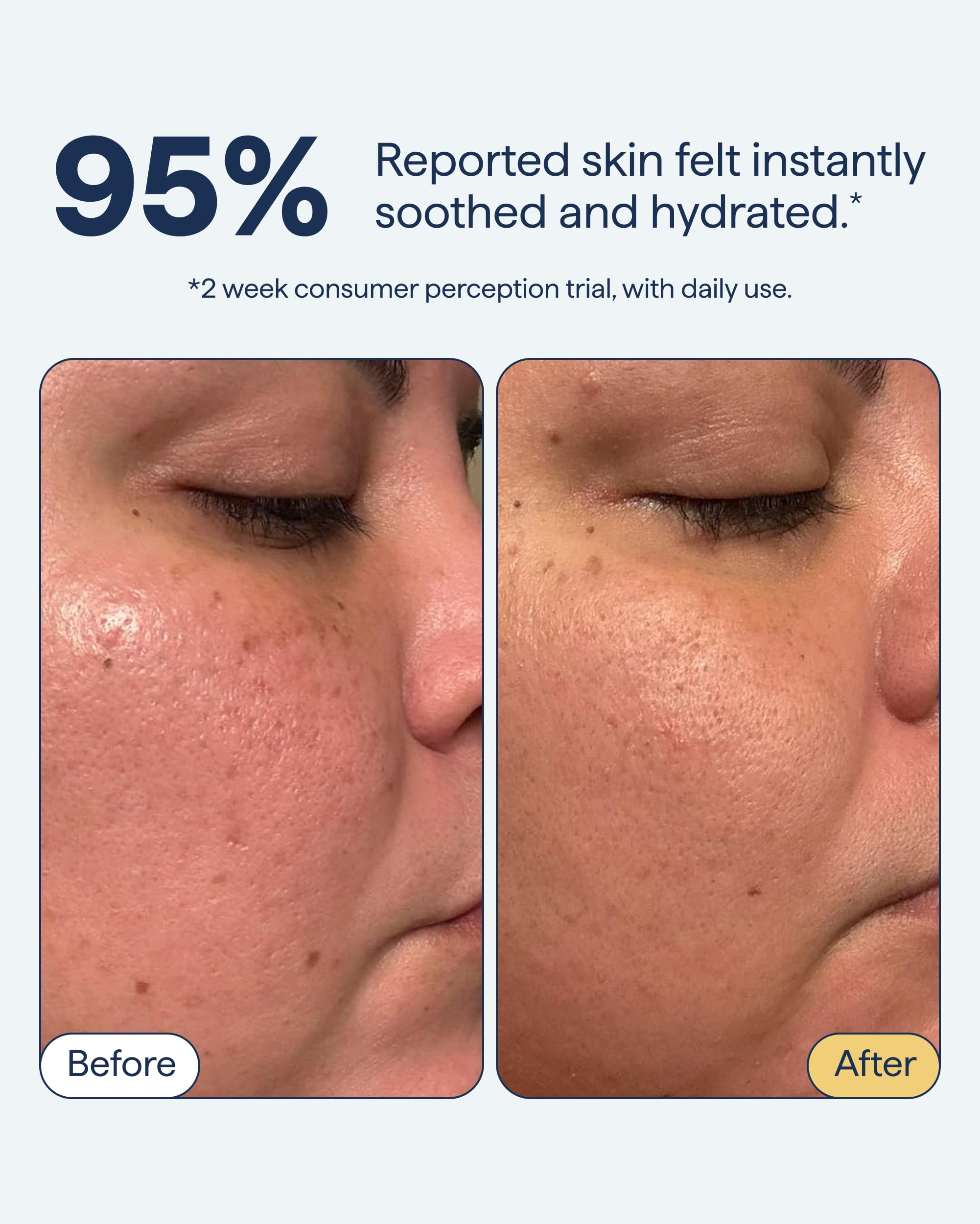 Remedy for Light Moisture – Barrier-Repairing Hydrating Gel Moisturizer for Normal to Oily Skin | Remedy Science