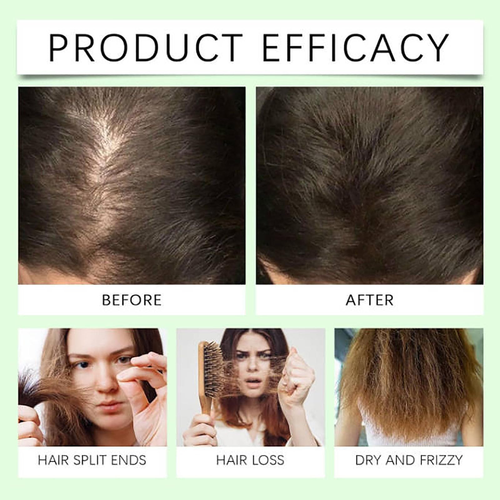 Remimpi Anti Hair Loss Shampoo | Strengthen, Cleanse & Support Hair Growth for All Hair Types