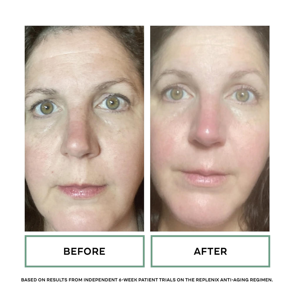 Replenix Age Restore Retinol Eye Repair | Medical-Grade Anti-Aging Eye Cream