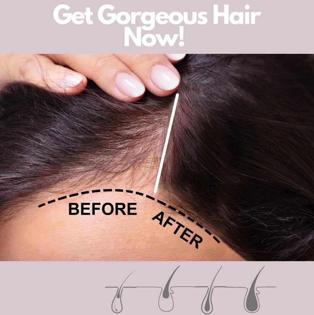 Rev320 320Pure Hair Vitamin Booster Spray – Strengthen & Stimulate Hair Growth