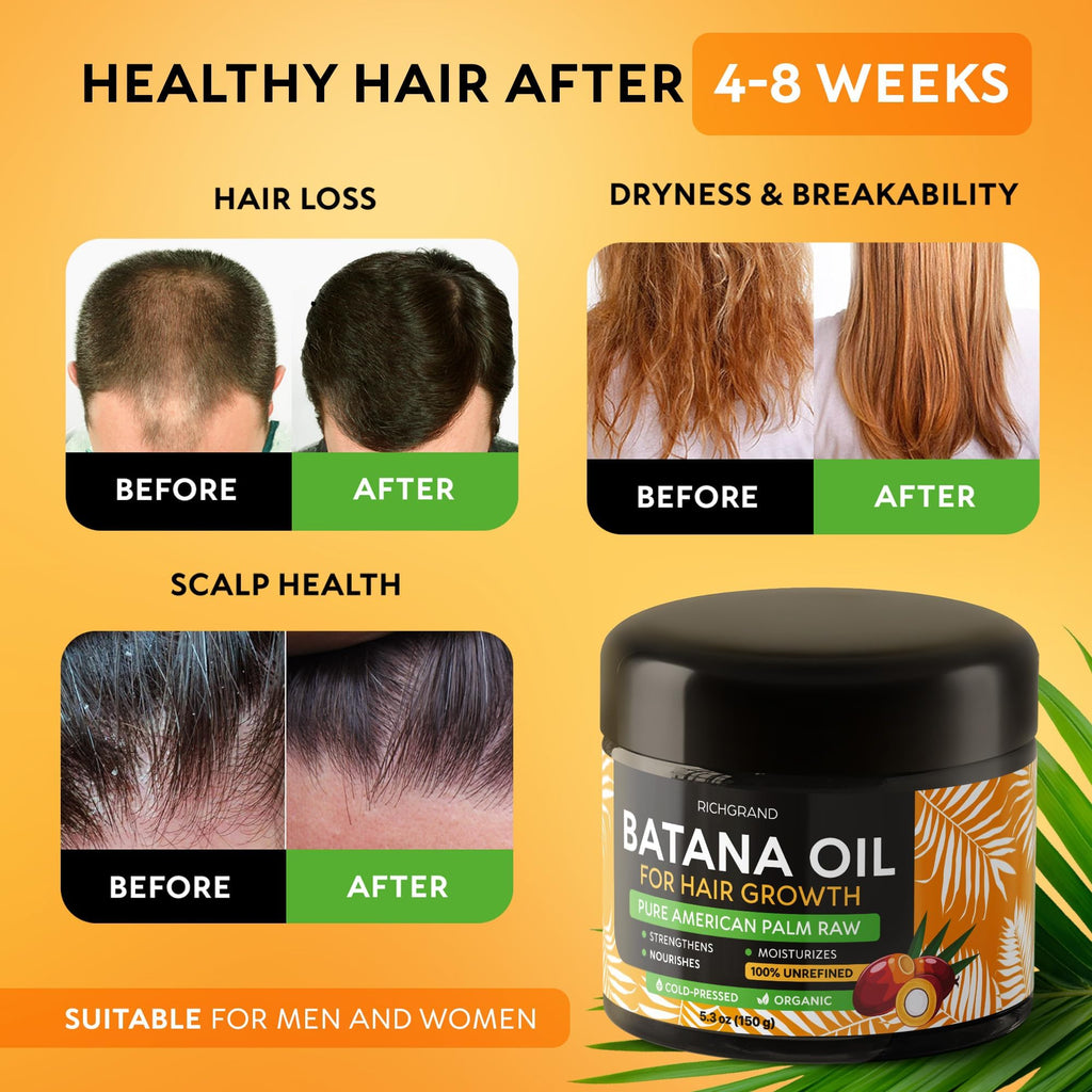 RICHGRAND Batana Oil – 100% Raw Unrefined Batana Butter for Hair & Skin (5.3 oz)