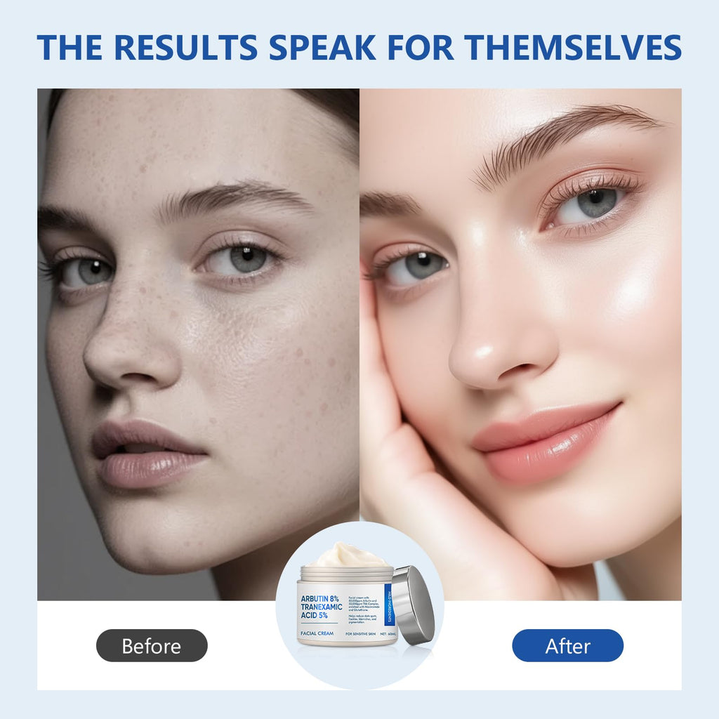 Richie House 8% Arbutin + 5% Tranexamic Acid Cream – 60ml Brightening Treatment