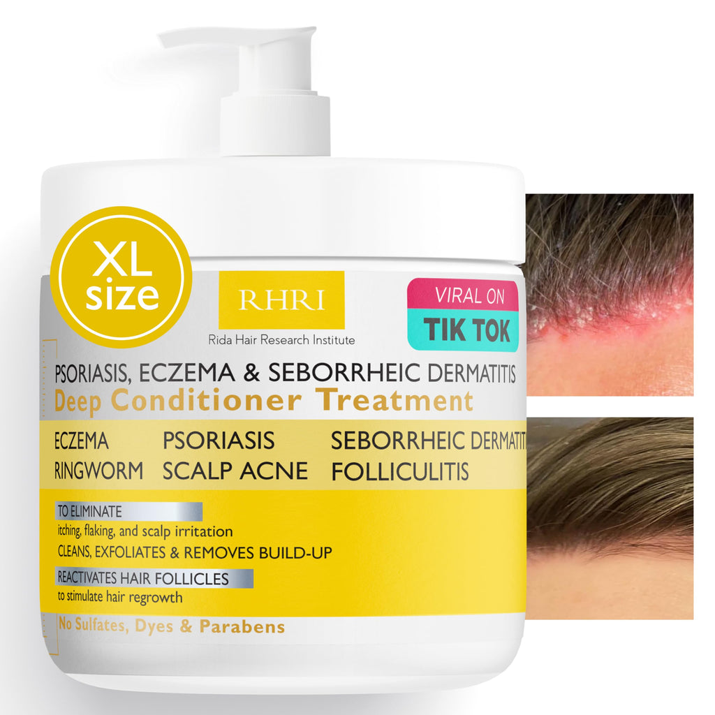 Anti Fungal Psoriasis Conditioner | DHT Blockers & Tea Tree Oil | Rida Hair Research Institute