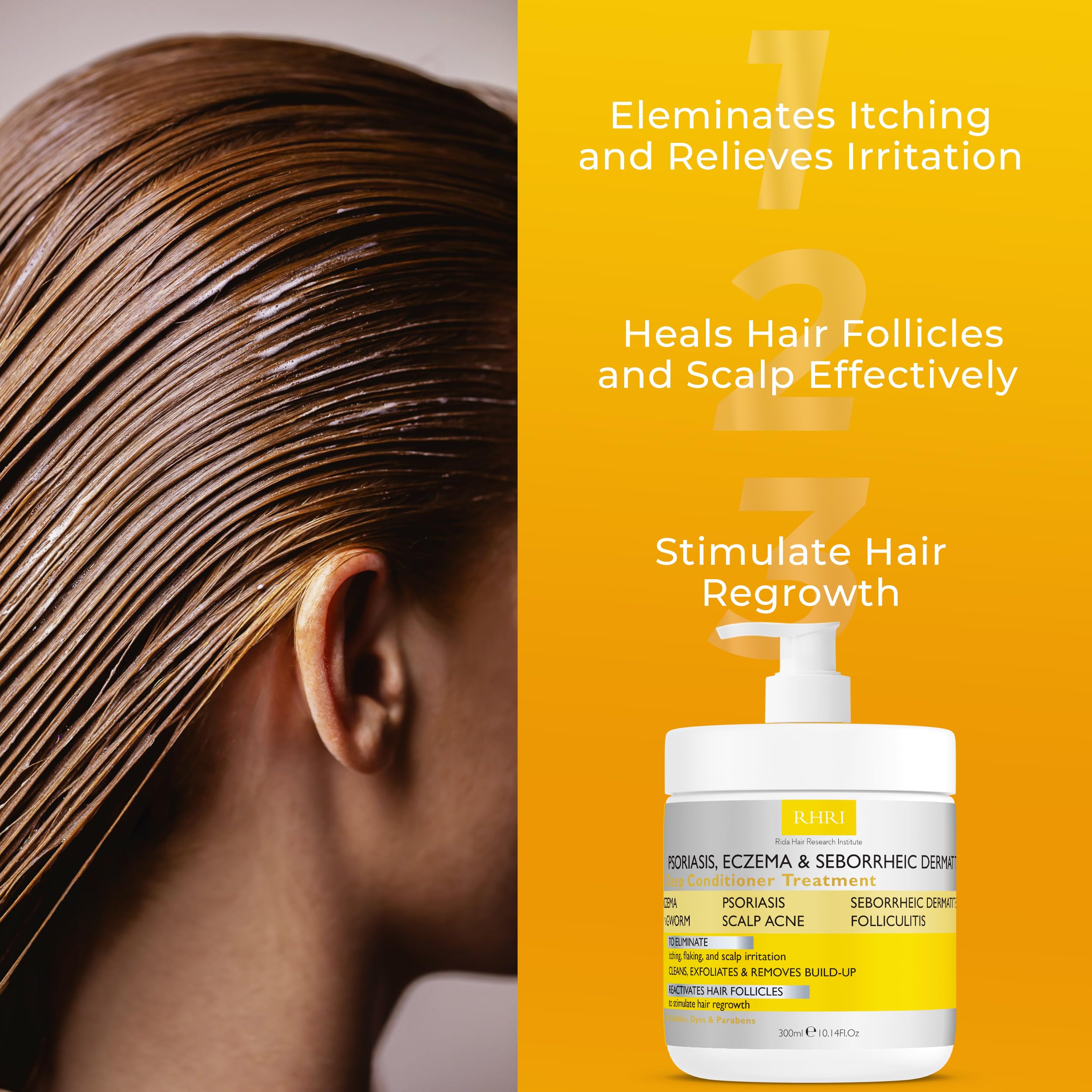 Anti Fungal Psoriasis Conditioner | DHT Blockers & Tea Tree Oil | Rida Hair Research Institute