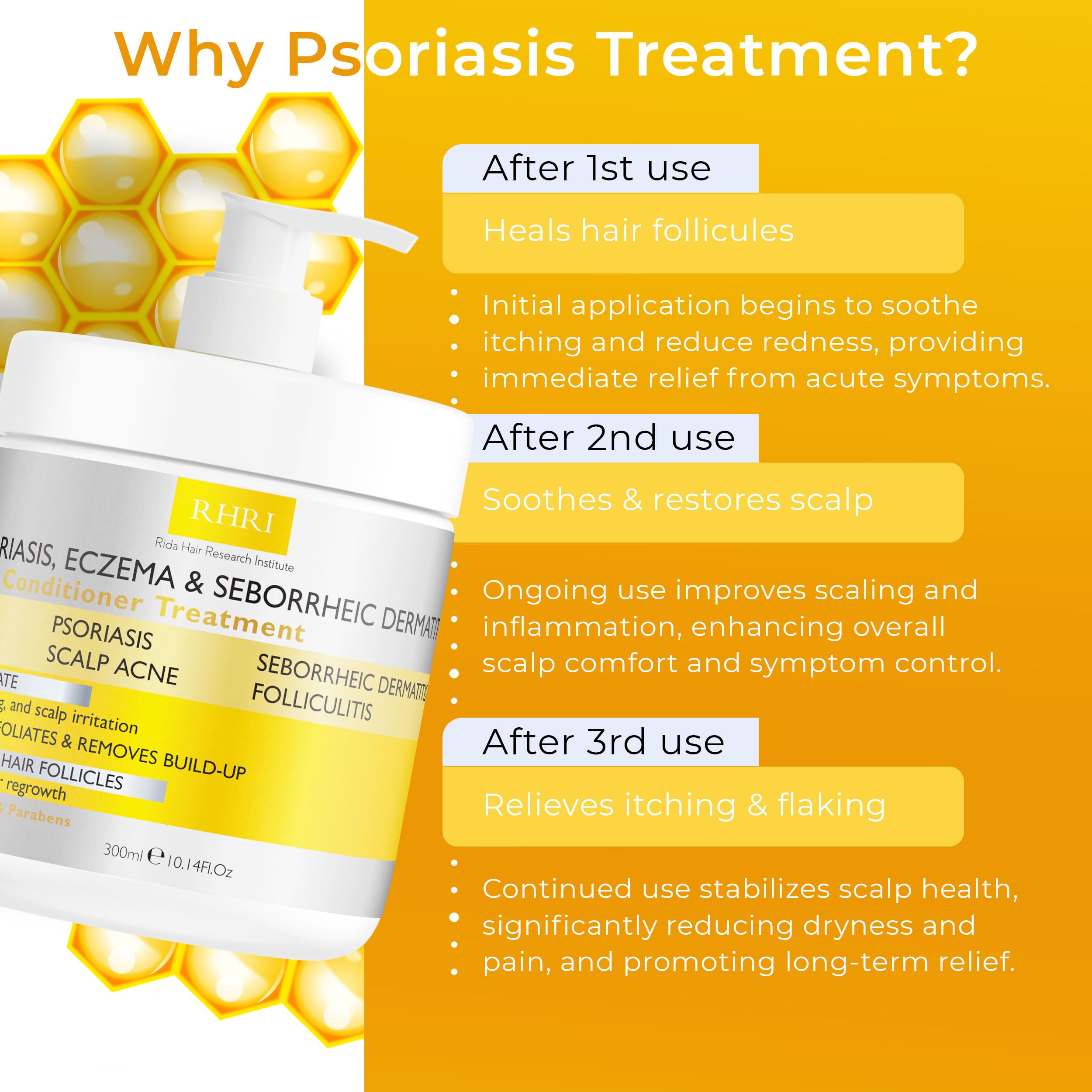 Anti Fungal Psoriasis Conditioner | DHT Blockers & Tea Tree Oil | Rida Hair Research Institute