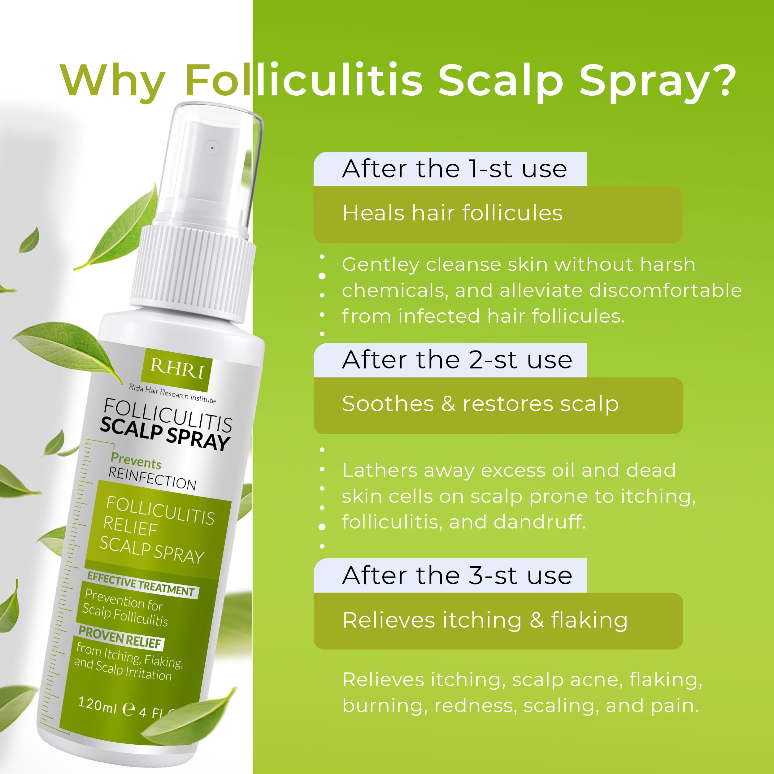Folliculitis Scalp Spray — Dandruff & Psoriasis Relief | Rida Hair Research Institute