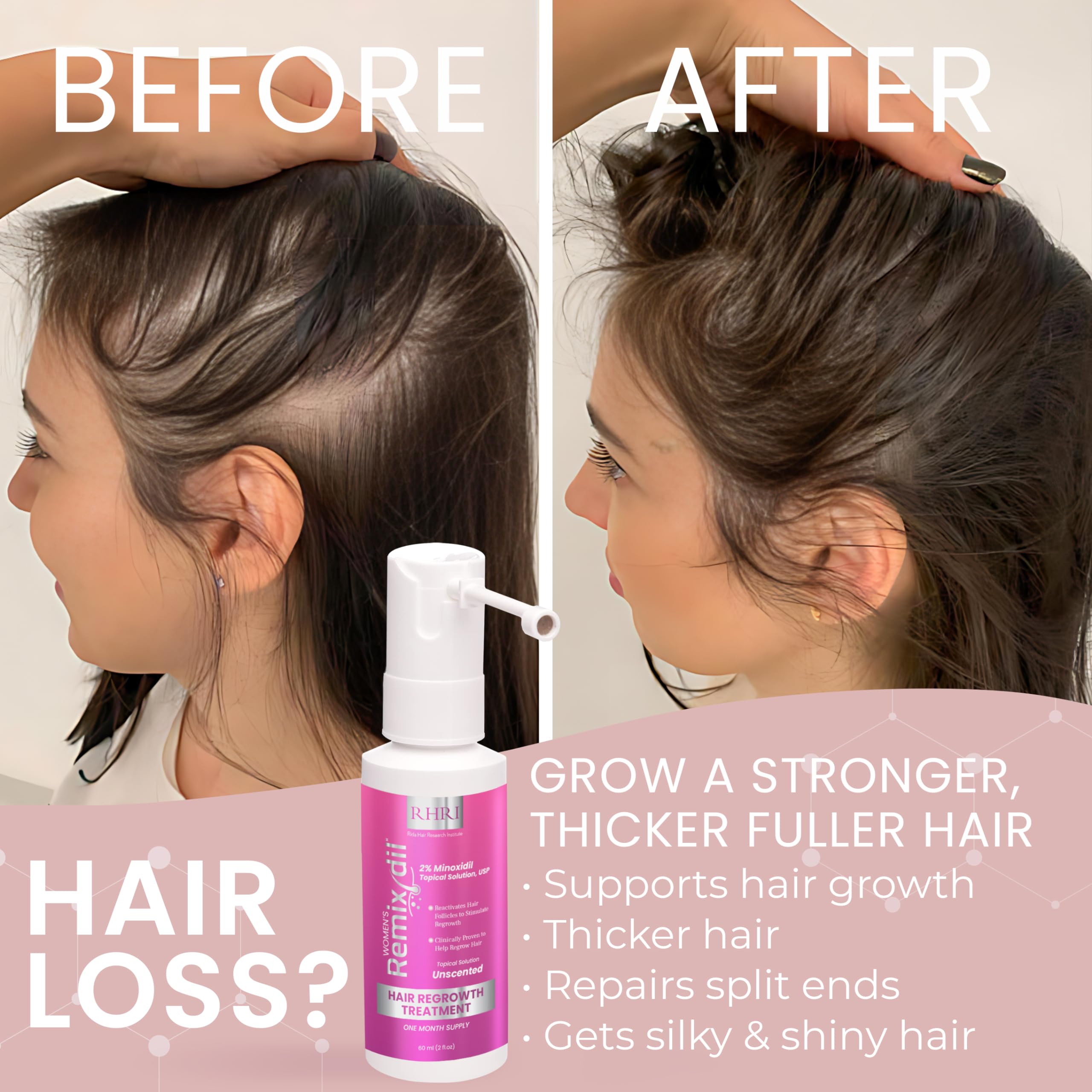Rida Hair Research Institute 2% Minoxidil for Women – Hair Regrowth Spray, 60 ml