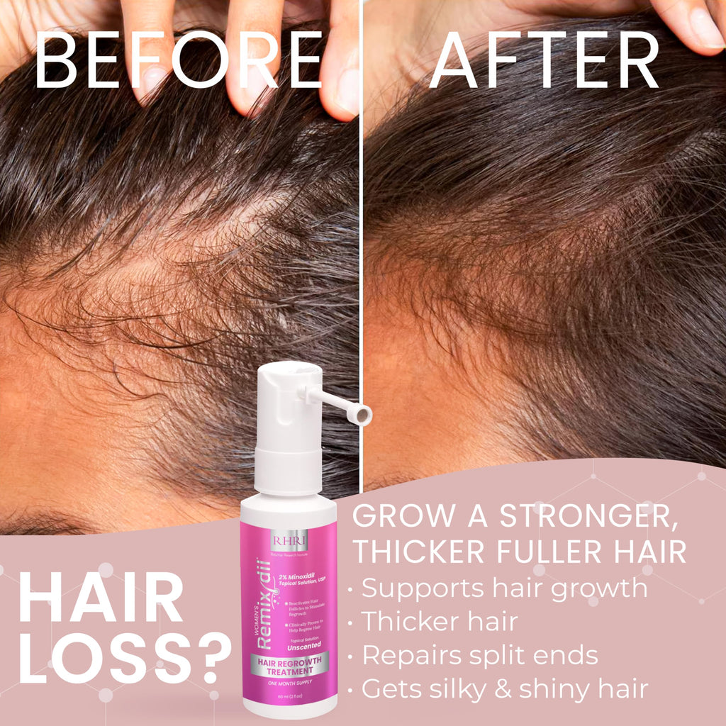 Rida Hair Research Institute 2% Minoxidil for Women – Hair Regrowth Spray, 60 ml