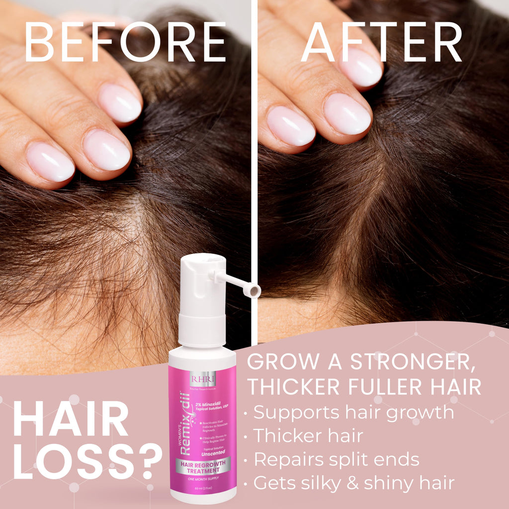 Rida Hair Research Institute 2% Minoxidil for Women – Hair Regrowth Spray, 60 ml