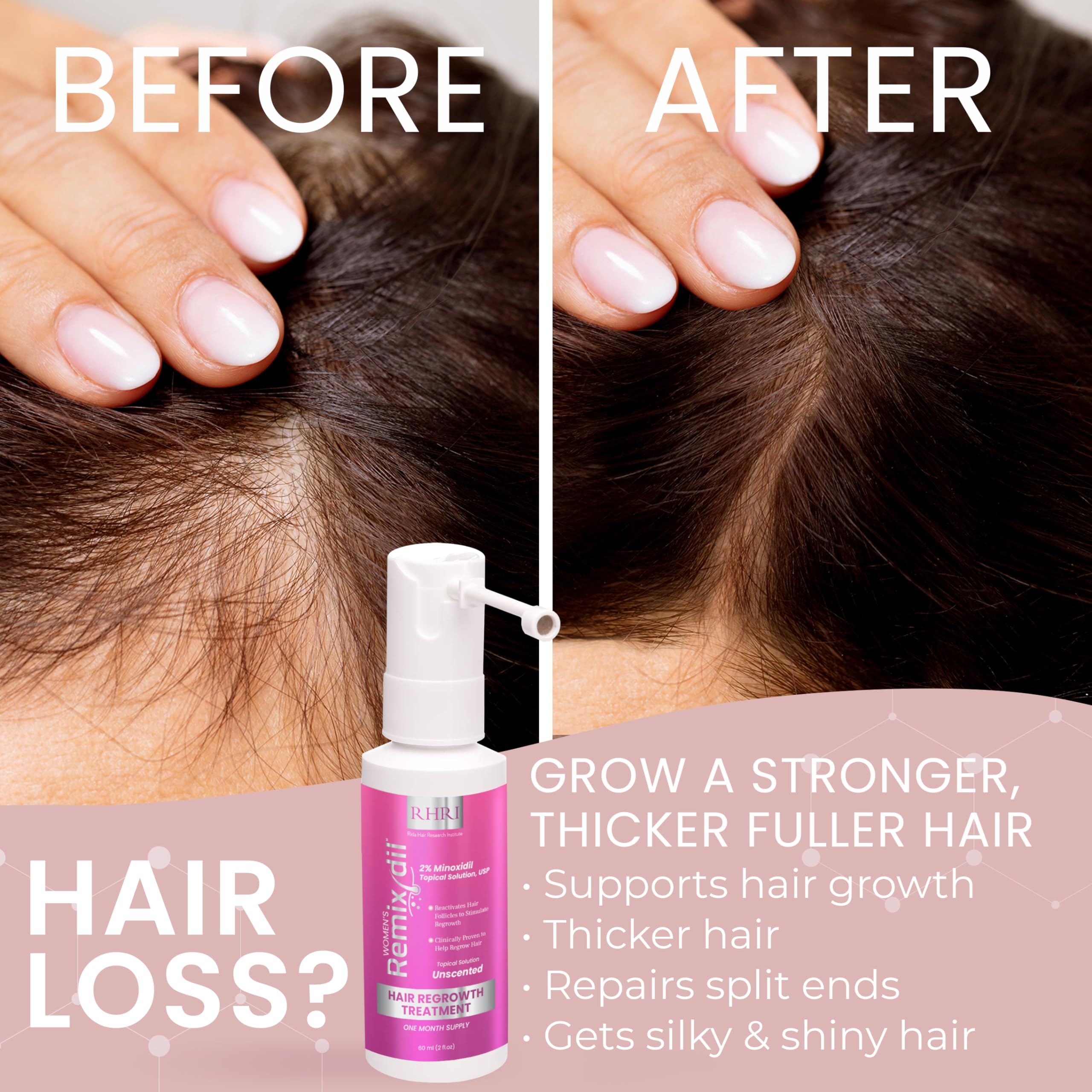 Rida Hair Research Institute 2% Minoxidil for Women – Hair Regrowth Spray, 60 ml