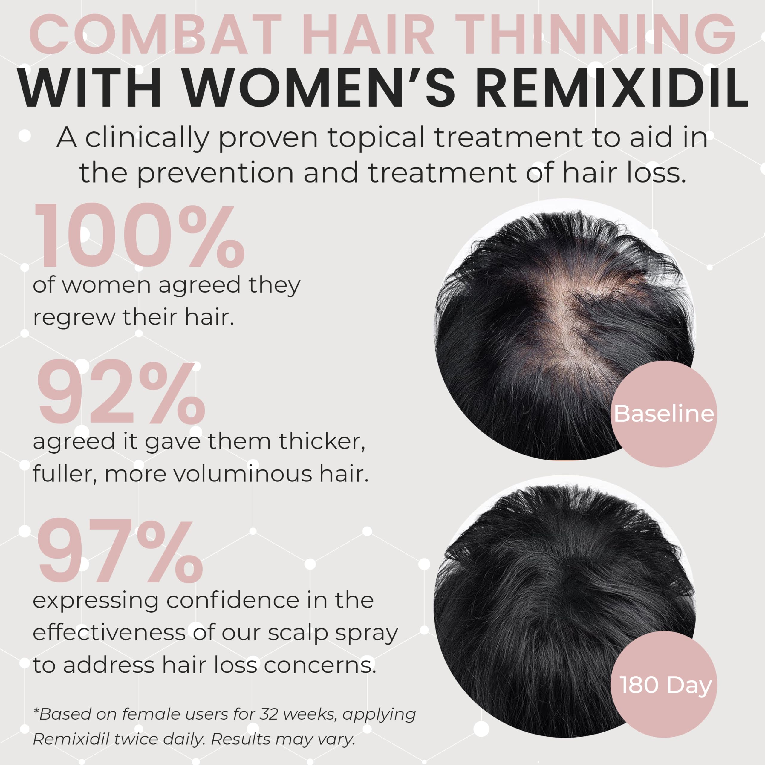 Rida Hair Research Institute 2% Minoxidil for Women – Hair Regrowth Spray, 60 ml