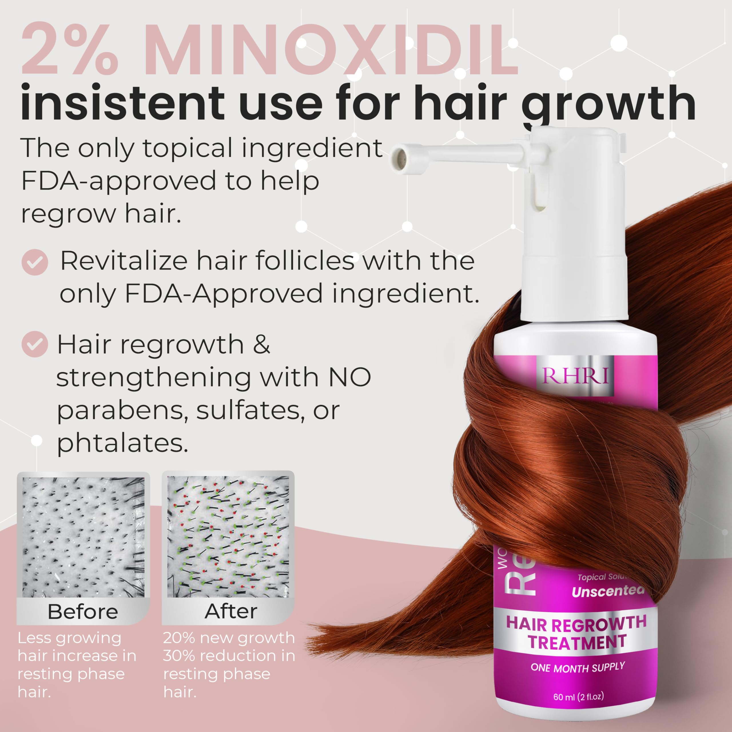 Rida Hair Research Institute 2% Minoxidil for Women – Hair Regrowth Spray, 60 ml
