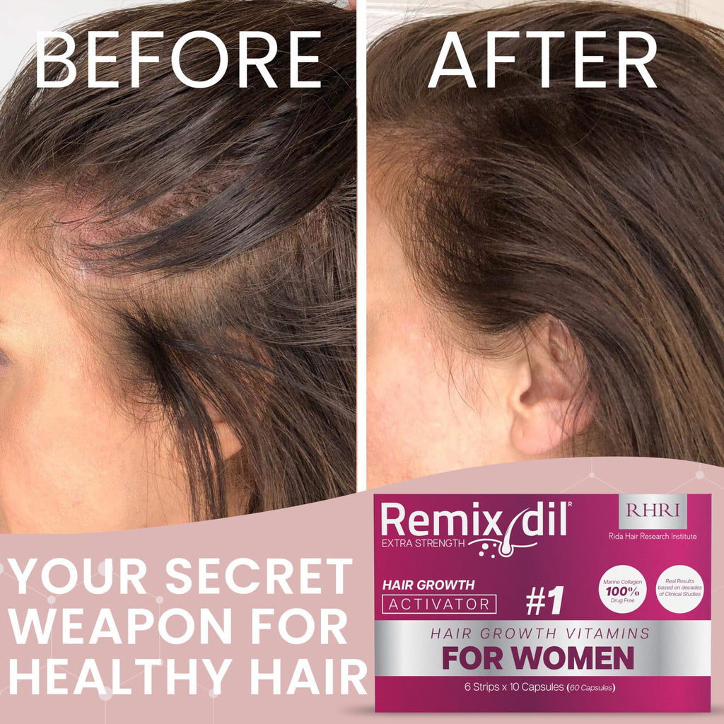 Hair Growth Vitamins for Women | Rida Hair Research Institute | 60 Capsules