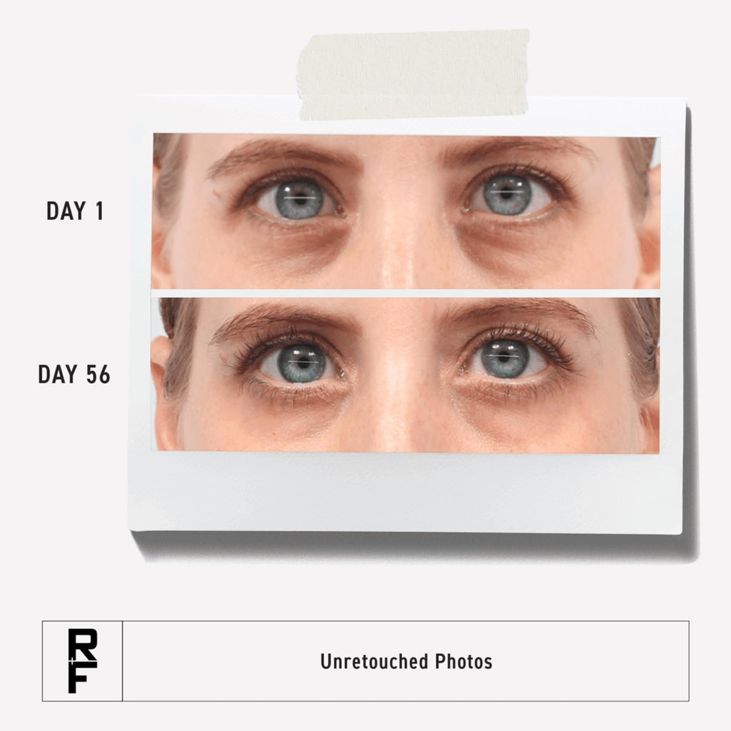 RODAN + FIELDS Active Hydration Bright Eye Complex | 15ml | Hydrating Eye Cream