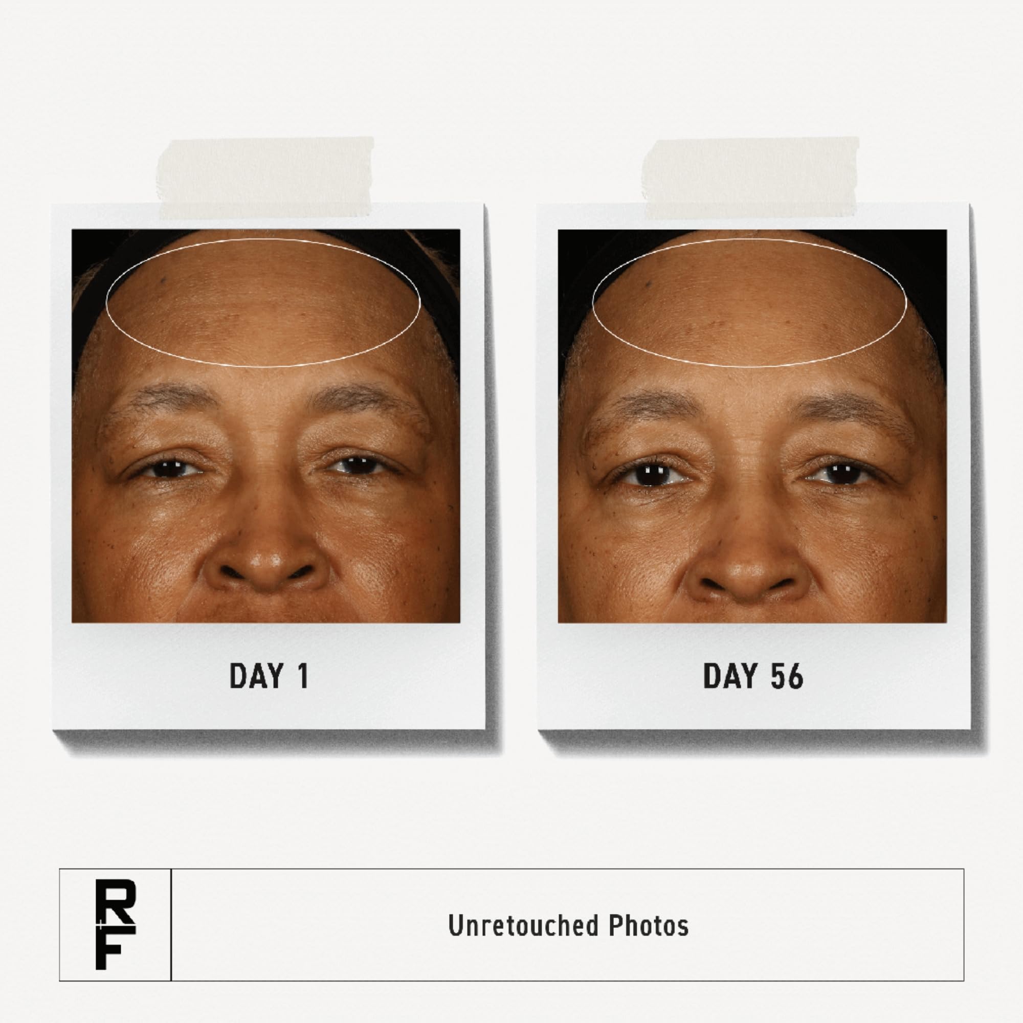 RODAN + FIELDS Redefine Overnight Restorative Cream – Step 3 PM Night Moisturizer with Glycolic Acid & Bakuchiol