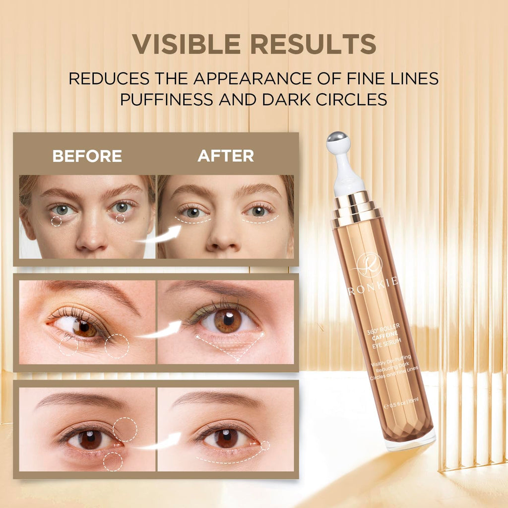 RONKIE Eye Cream for Dark Circles: Caffeine + Retinol for Brighter Eyes – Reduces Puffiness & Fine Lines (Gold)