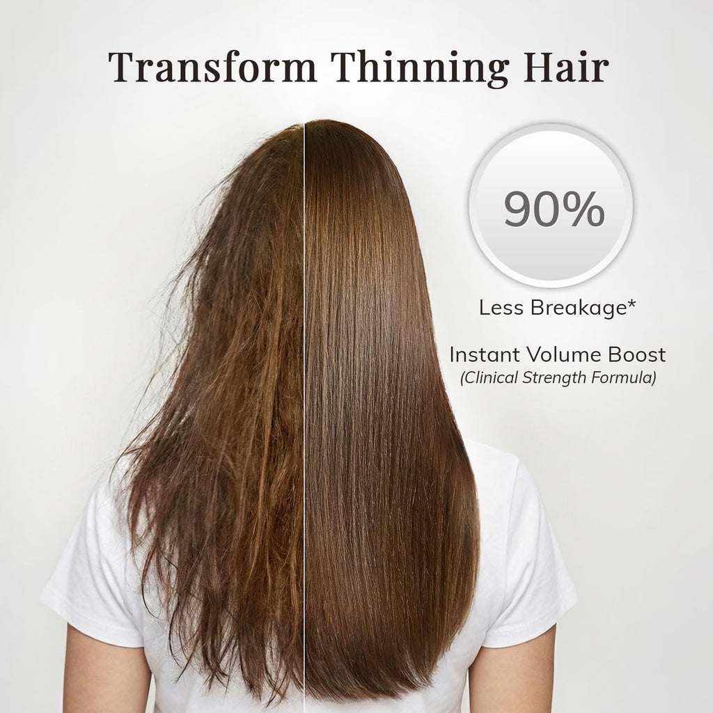 RootStim Rosemary Conditioner for Hair Growth & Thinning Hair | Saw Palmetto, Keratin & Argan Oil