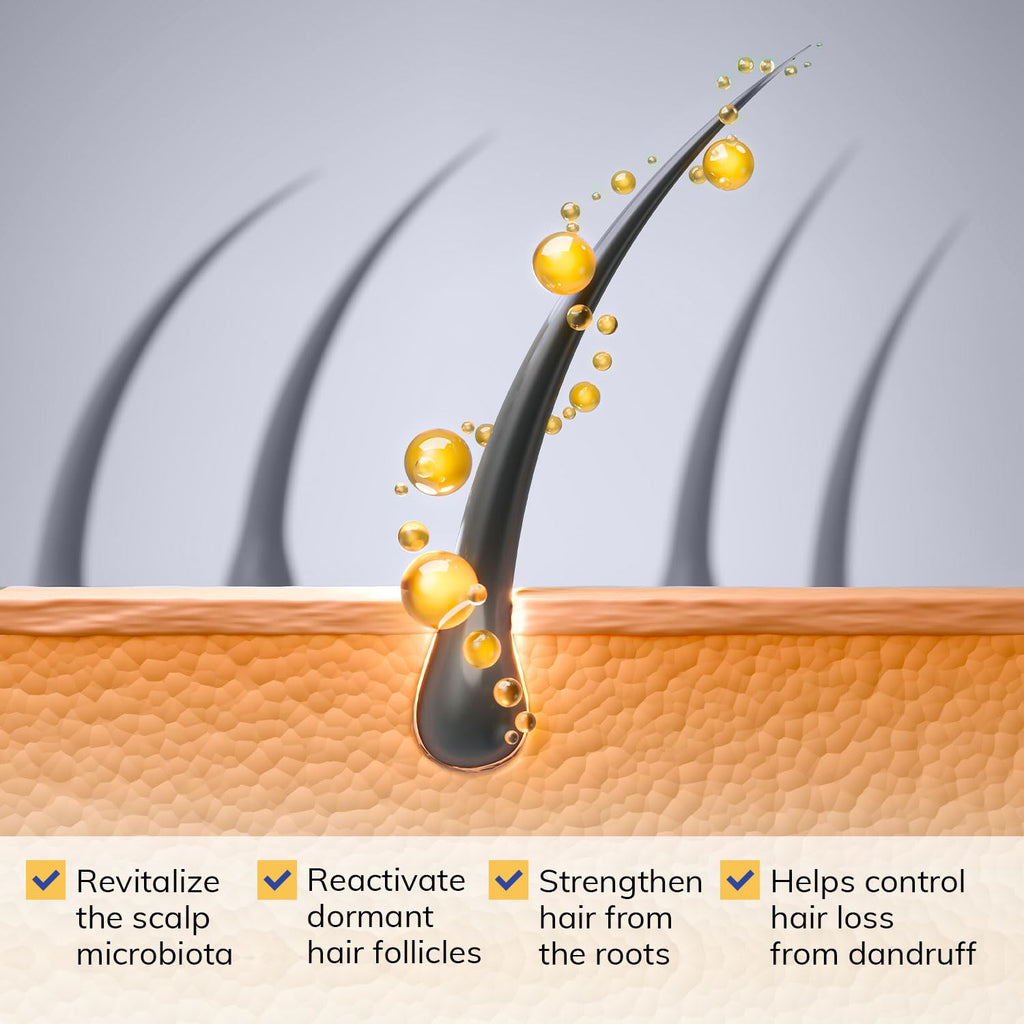 RootStim Seborrheic Dermatitis Shampoo | Dandruff & Itchy Scalp Relief with Selenium Sulfide
