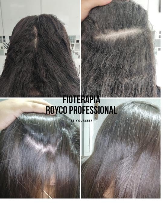 Royco Professional Fioterapia Brazilian Keratin Treatment – Organic Hair Smoothing, Straightening & Nourishment (16.9 oz)