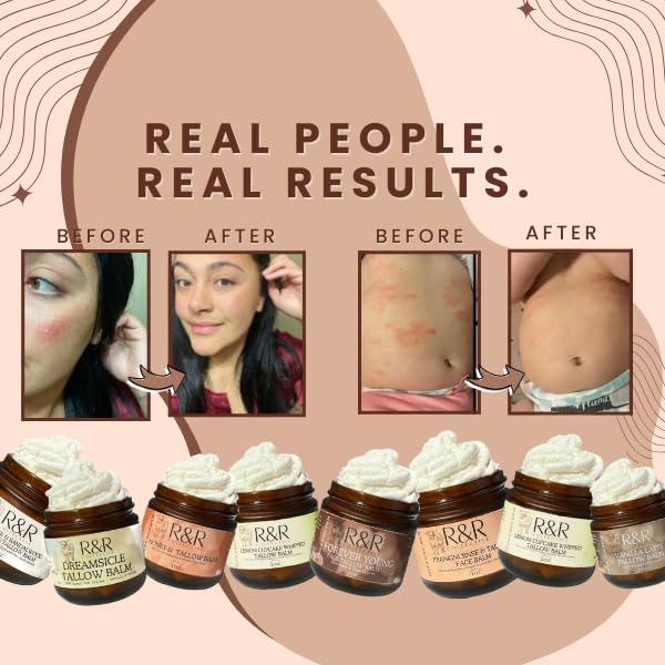 R&R Collective Handmade Honey & Tallow Balm – 2 oz, 100% Grass-Fed Beef Tallow, Natural Whipped Skincare