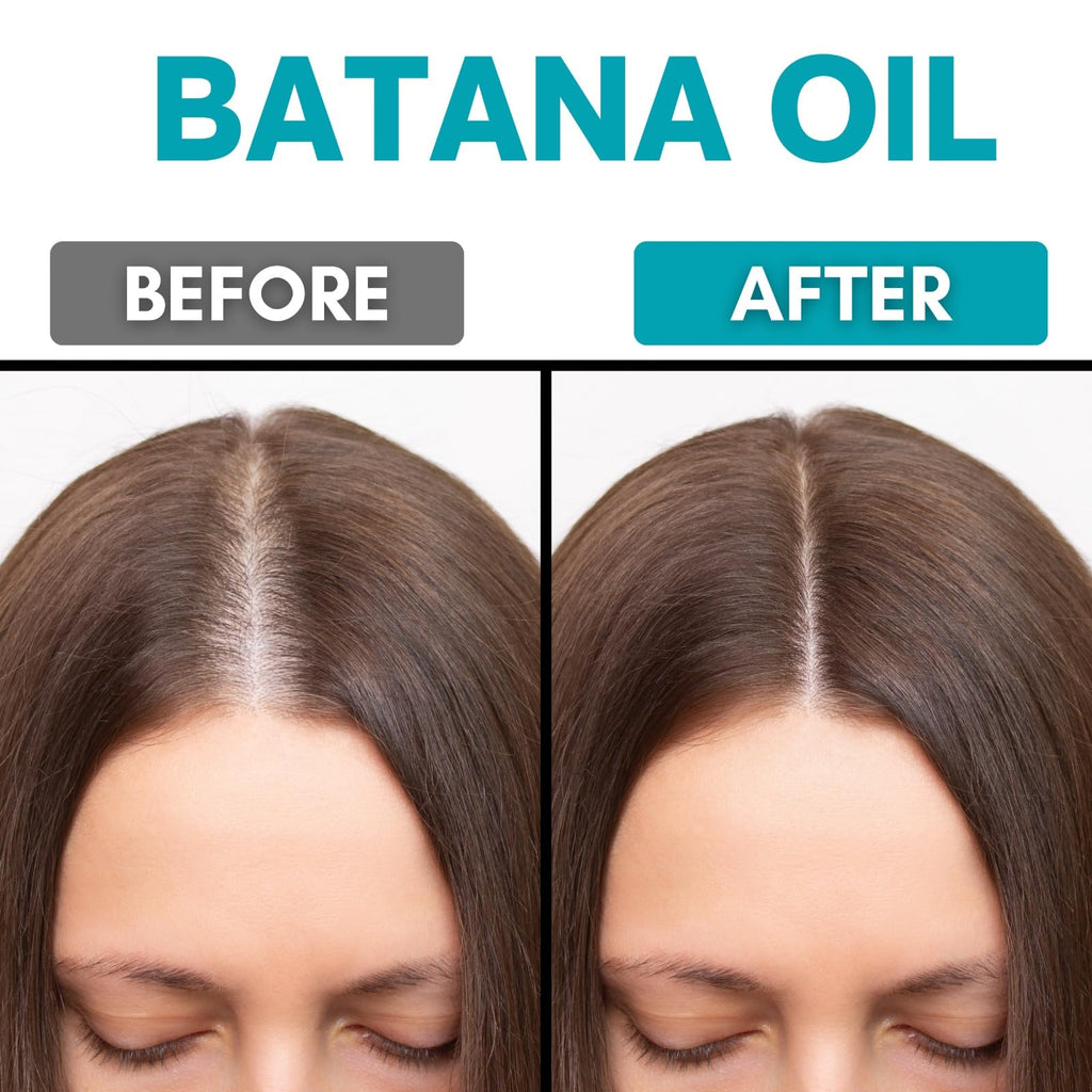 SAHAK Raw Batana Oil for Hair Growth – Honduras Sourced, 4.23 fl oz, 100% Pure