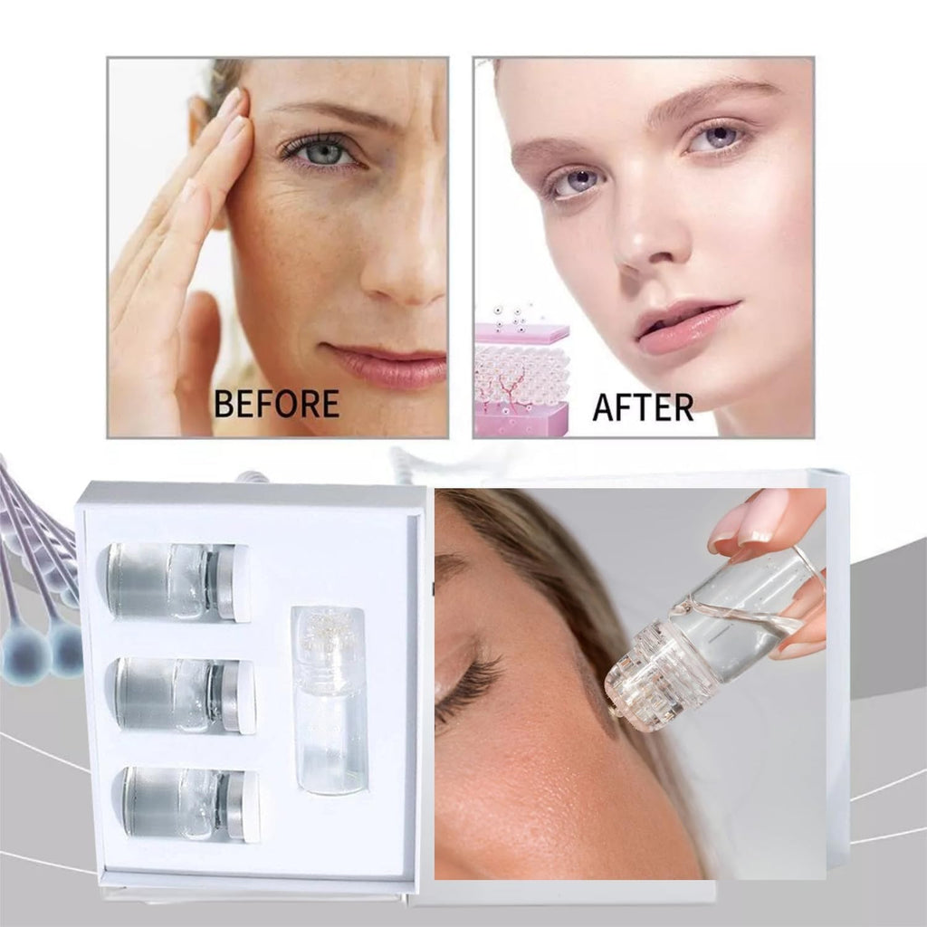 Saranova Beauty Micro Infusion System for Face — Moisturizing Serum & Stamp (1-Month Supply)