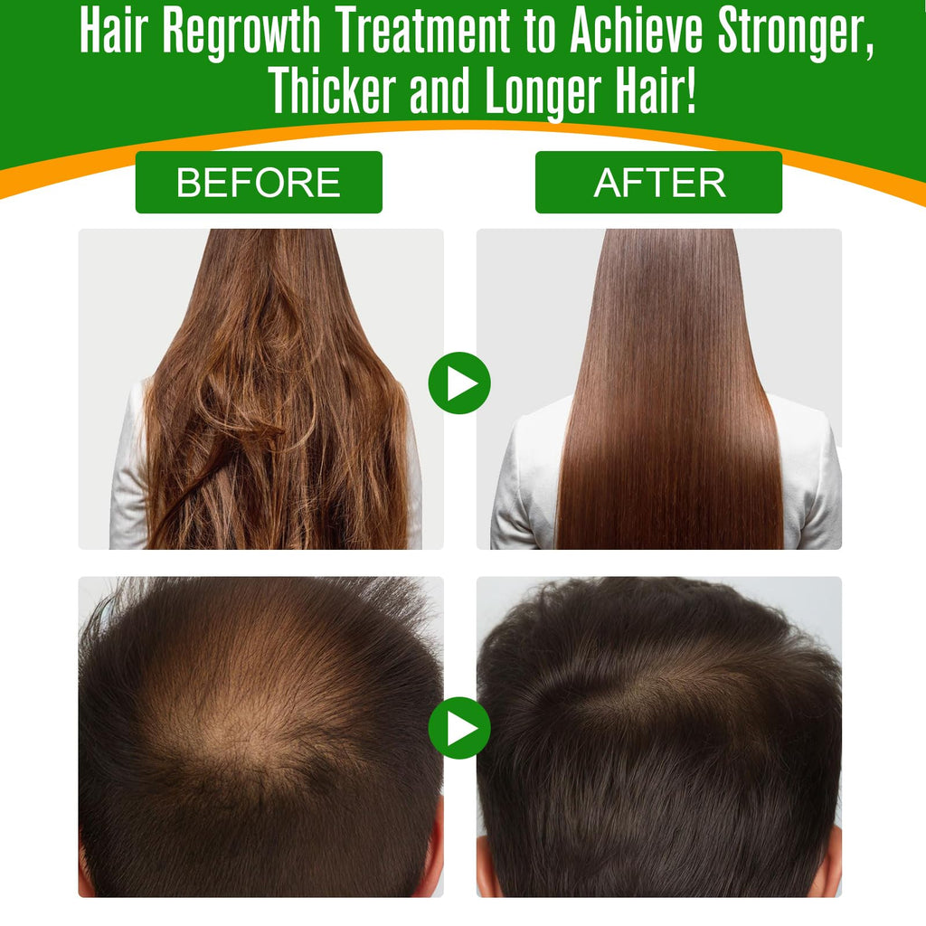 SBHEANGBA Batana Oil for Hair Growth – 60ml, 100% Pure Cold-Pressed Organic Batana Oil
