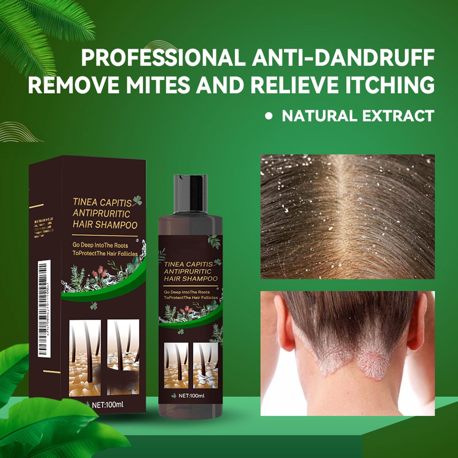 Scalp Flakes Antipruritic Shampoo – Natural Dandruff Care, Scalp Relief, 100ml