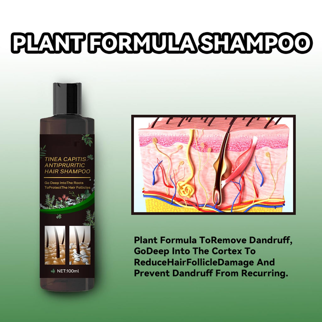 Scalp Flakes Antipruritic Shampoo – Natural Dandruff Care, Scalp Relief, 100ml