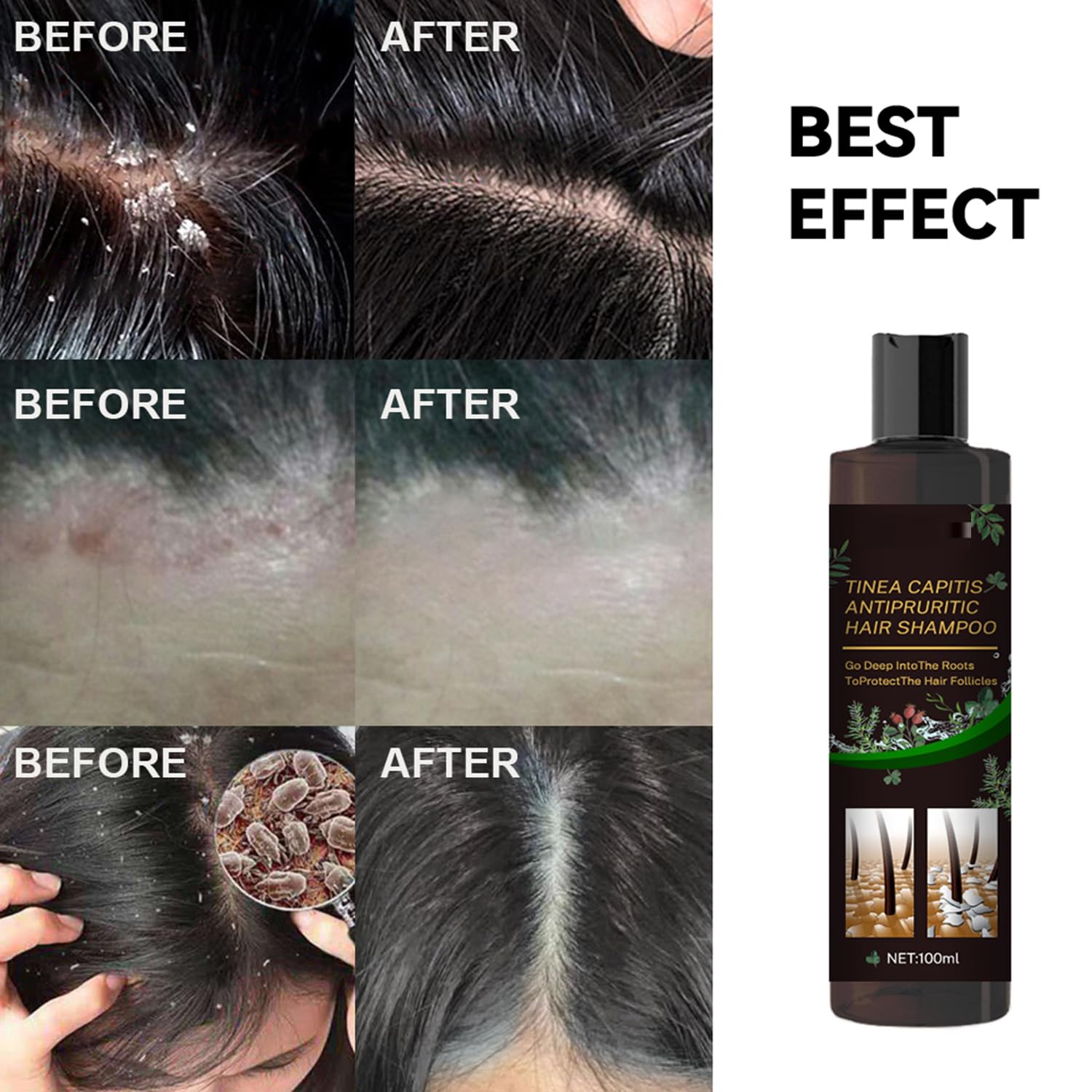 Scalp Flakes Antipruritic Shampoo – Natural Dandruff Care, Scalp Relief, 100ml