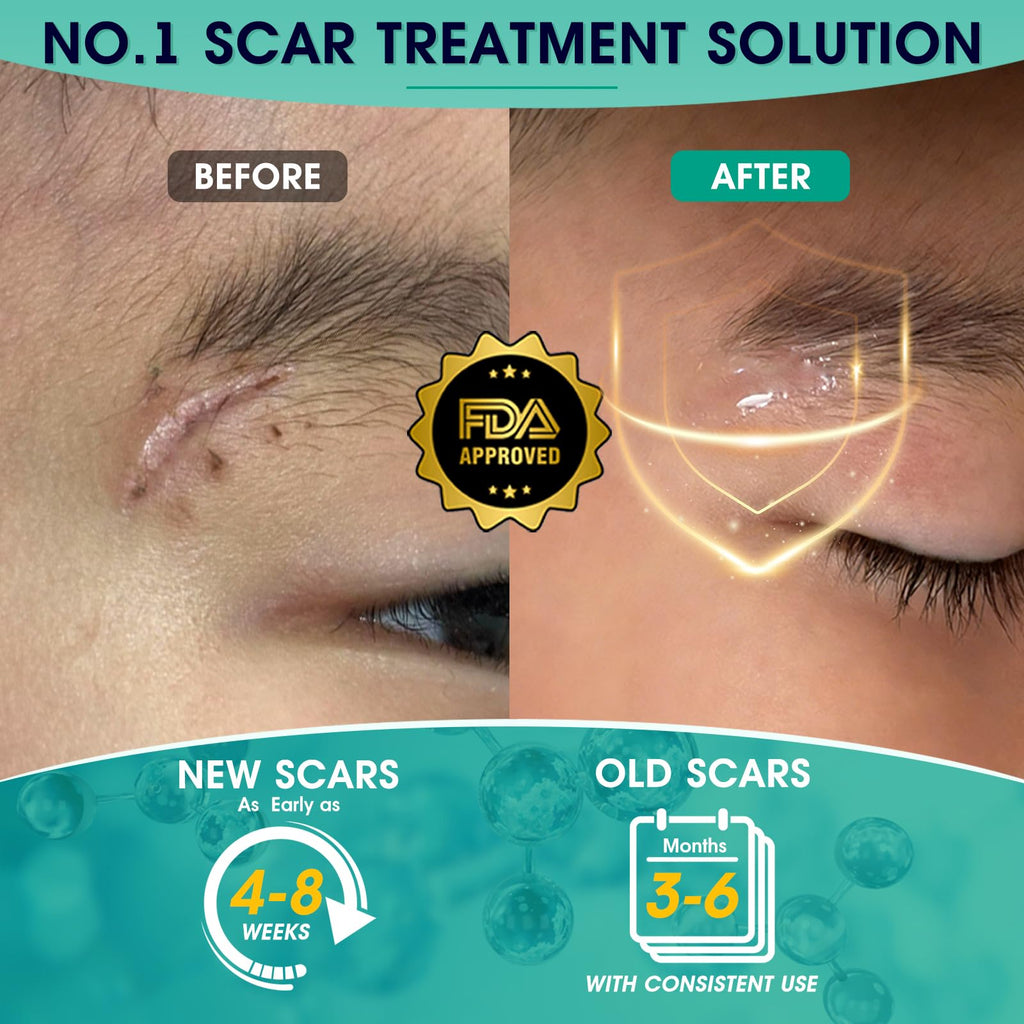 ScarMD Silicone Scar Gel – Roll-On Scar Cream for Surgical, Acne & Keloid Scars