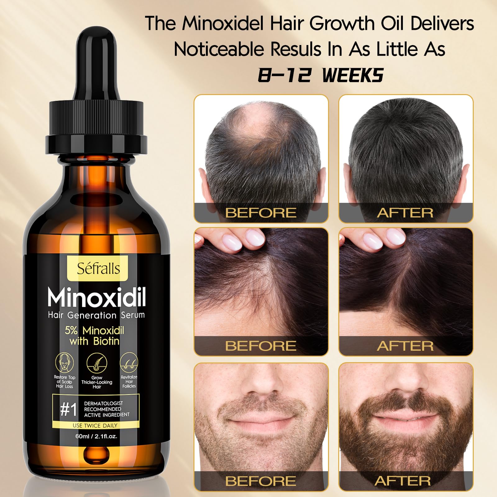 Sefralls 5% Minoxidil Hair Growth Oil Kit – Extra Strength Hair & Beard Regrowth Serum, 2.11 fl oz