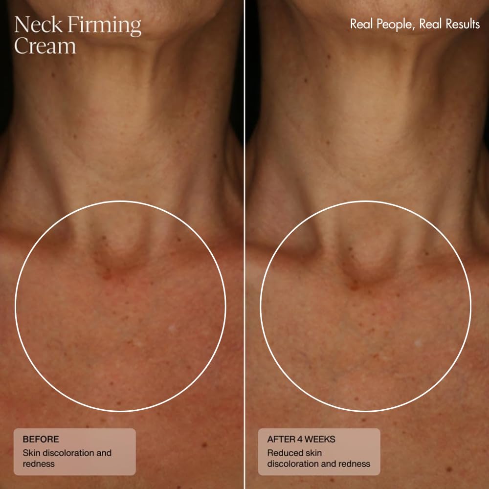 Sente Firming Neck Cream for Crepey Skin & Vertical Lines | Lifts, Firms & Smooths Neck & Décolleté | HSA, Caffeine, Vitamin C | 1.7 oz