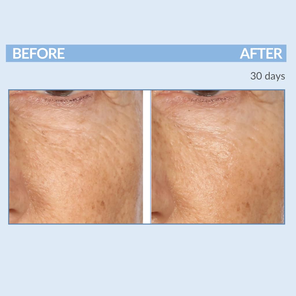 Serious Skincare A Force XR Retinol Serum Concentrate – Time-Release Anti-Aging (2 oz)