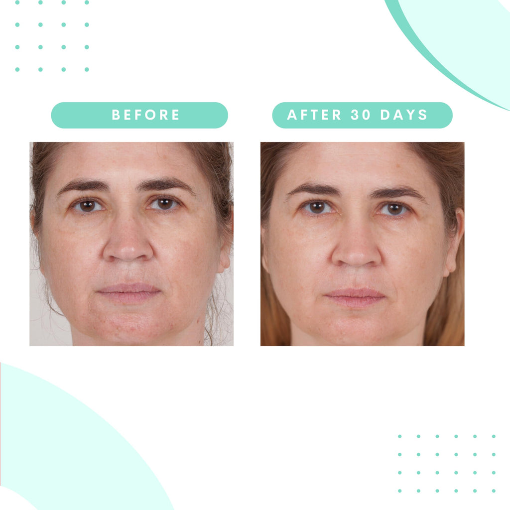 Serious Skincare Glycolic Radiant Skin Set — Cleanse, Exfoliate & Renew (3-Piece)