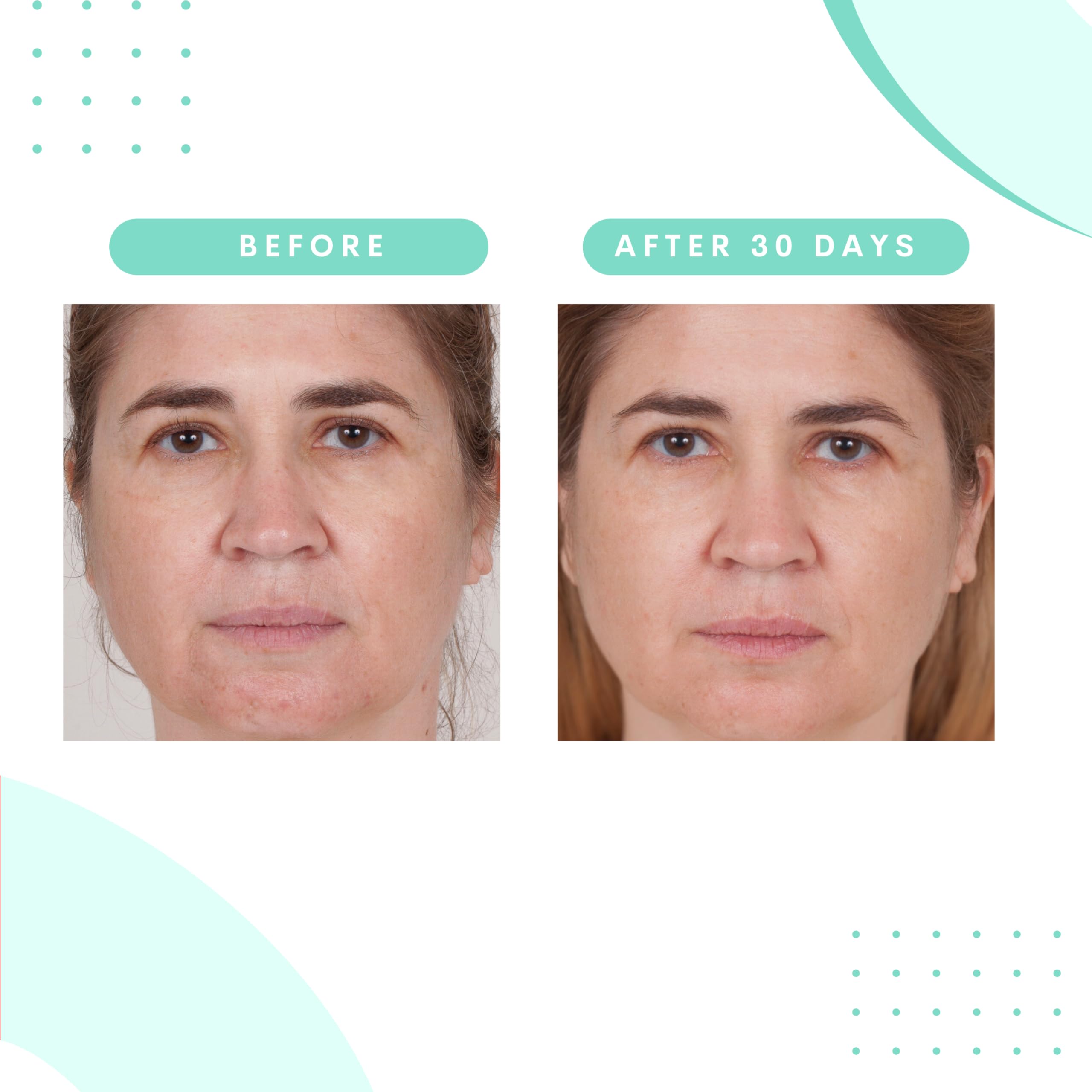 Serious Skincare Glycolic Gommage – Extreme Renewal Facial Mask, Micro Exfoliation