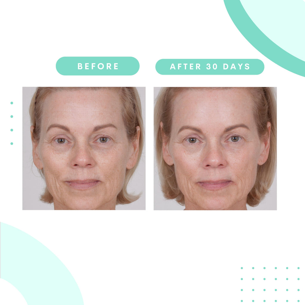 Serious Skincare Glycolic Gommage – Extreme Renewal Facial Mask, Micro Exfoliation