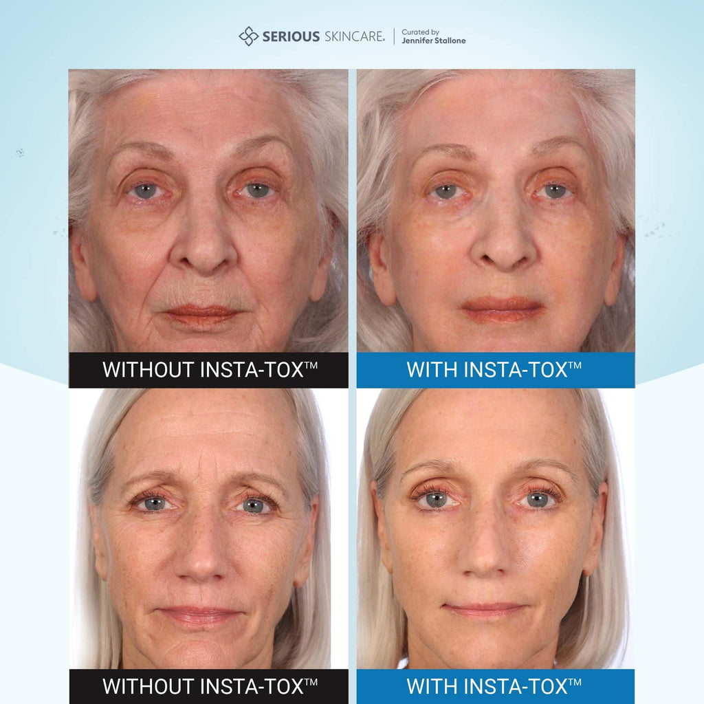 Serious Skincare INSTA-TOX Instant Wrinkle Filler – Quick Facial Tightening & Pore Blur 0.75 oz